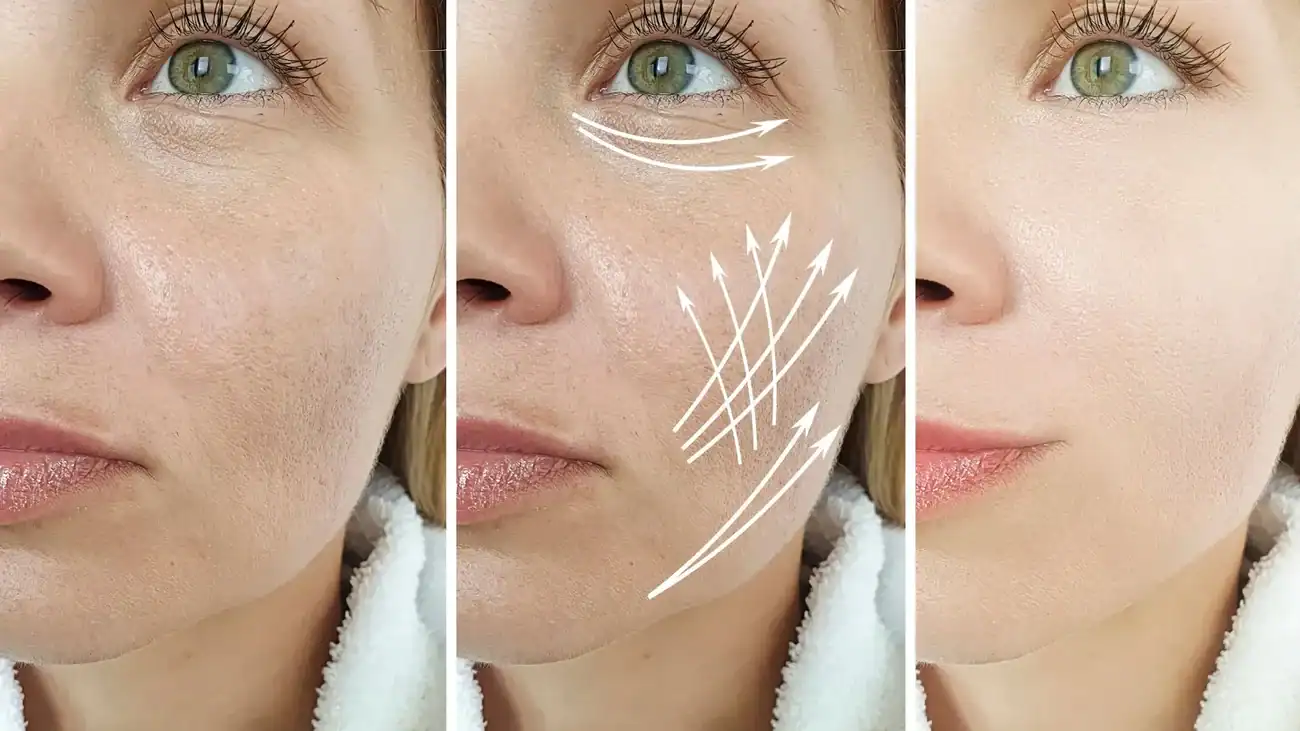 Can One Treatment Really Tackle More Than One Skin Concern Northwood?