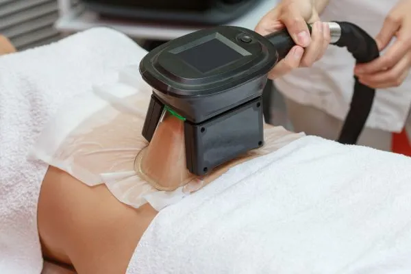 Image of person having fat freezing treatment to help weight gain Northwood