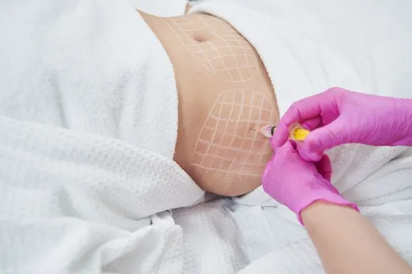 image of fat dissolving injections on love handles to help combat weight gain Northwood