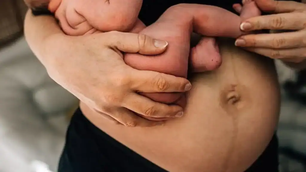 Why Is My Stomach Still Big After Pregnancy Northwood?