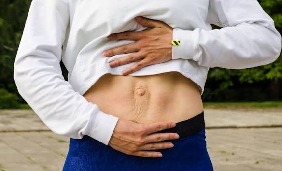 When Could Diastasis Recti Be the Missing Piece of the Puzzle Northwood?